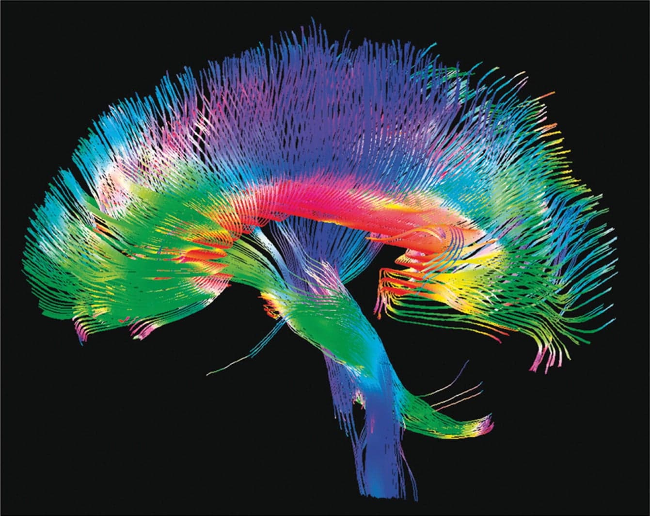 Human Connectome Project