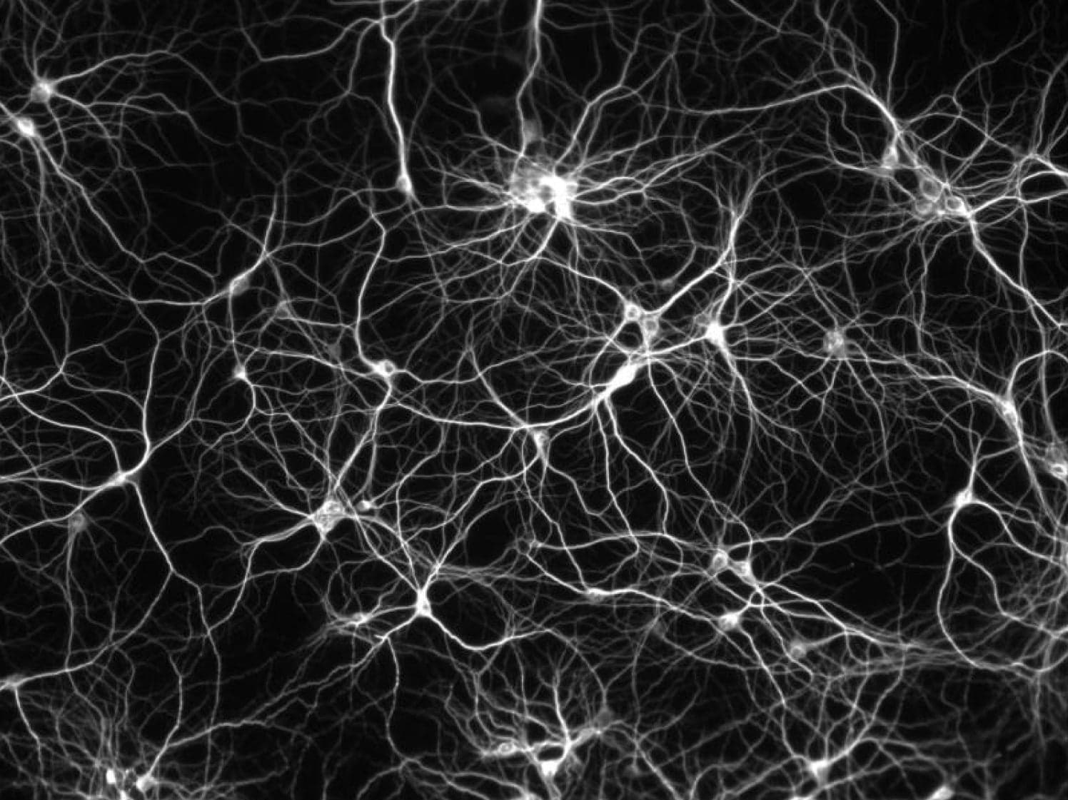 Neurons