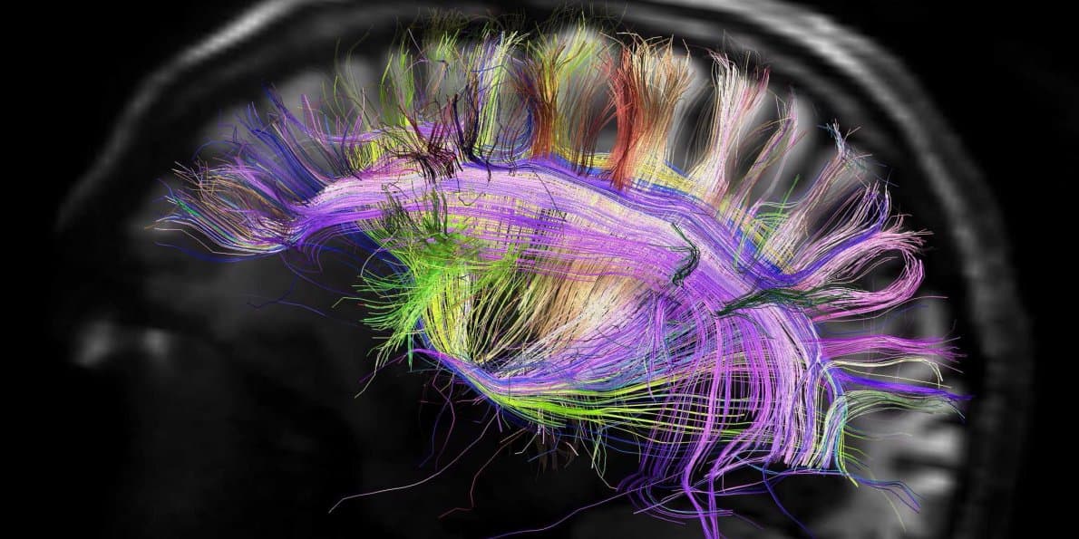 MGH-UCLA HUMAN CONNECTOME PROJECT