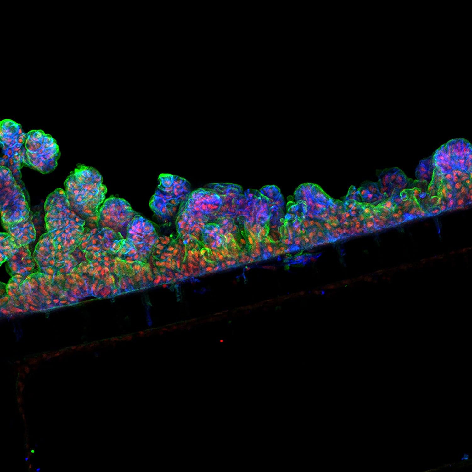 Cedars-Sinai Board of Governors Regenerative Medicine Institute