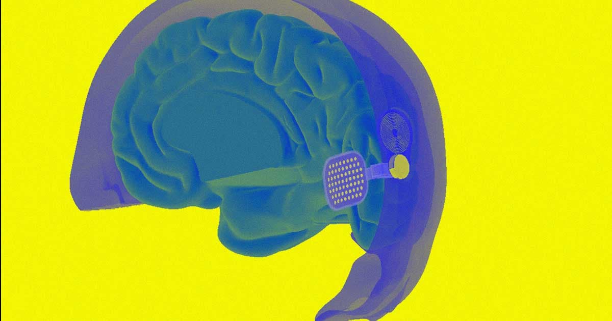 A Man's New Bionic Eye Lets Him See After an Accident Blinded Him