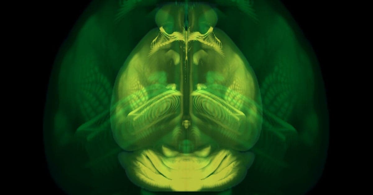 Allen Institute for Brain Science