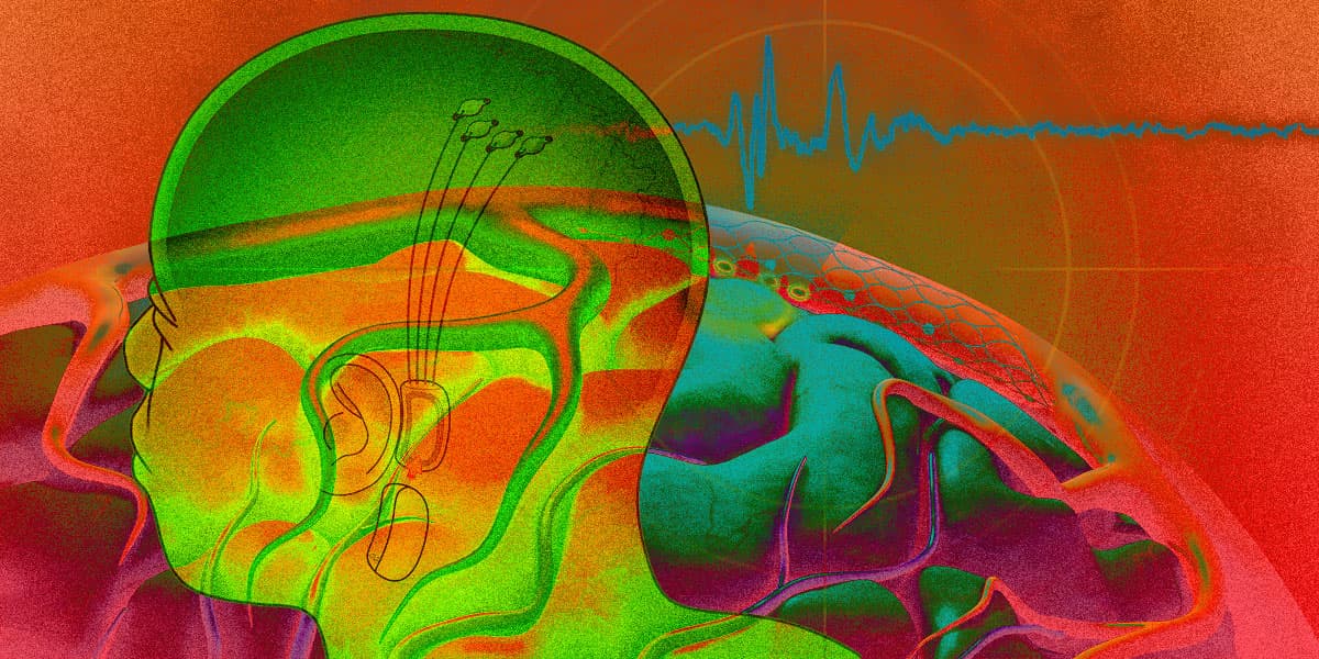 Neuralink/Synchron/Futurism