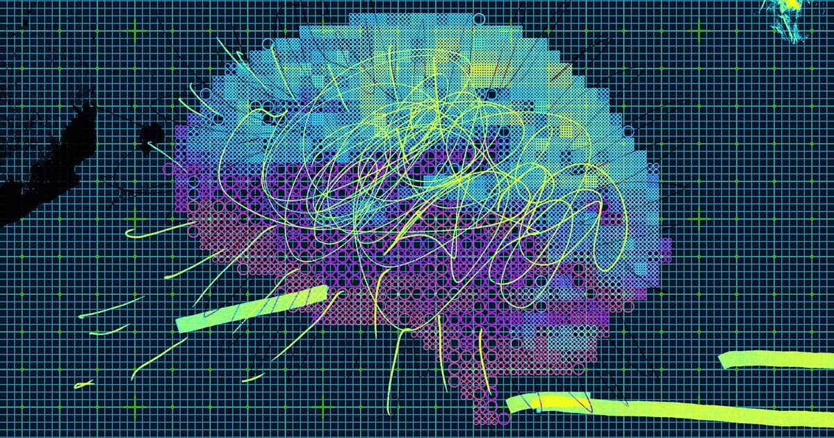 Brain Implant Companies Apparently Have an Extremely Dirty Secret