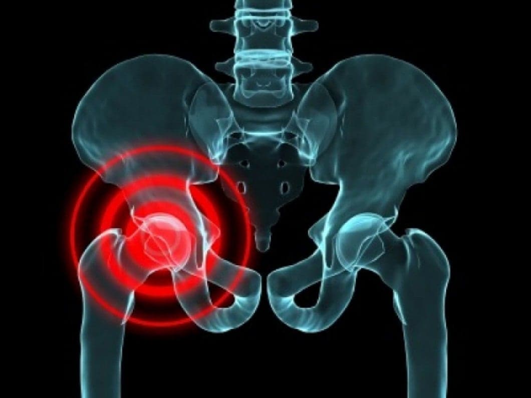 Scientists Have Genetically Engineered A 'Living Hip' That Will Remove Pain