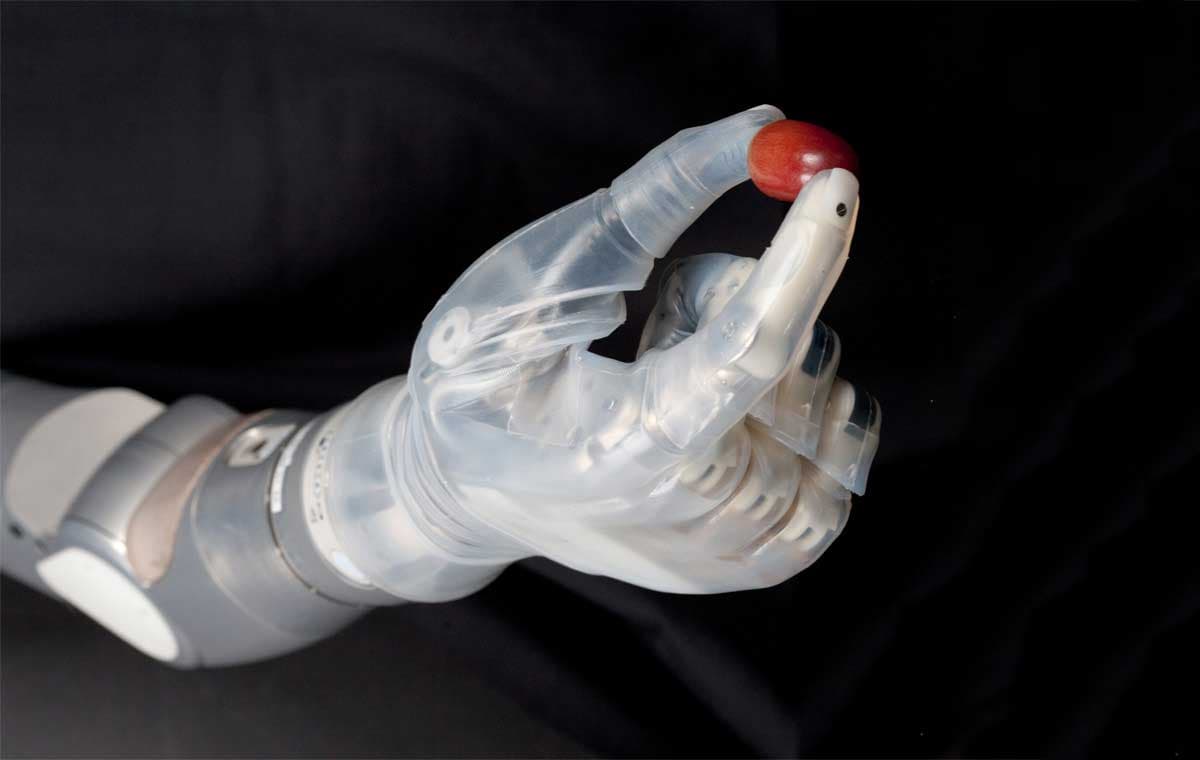 Mobious Bionics