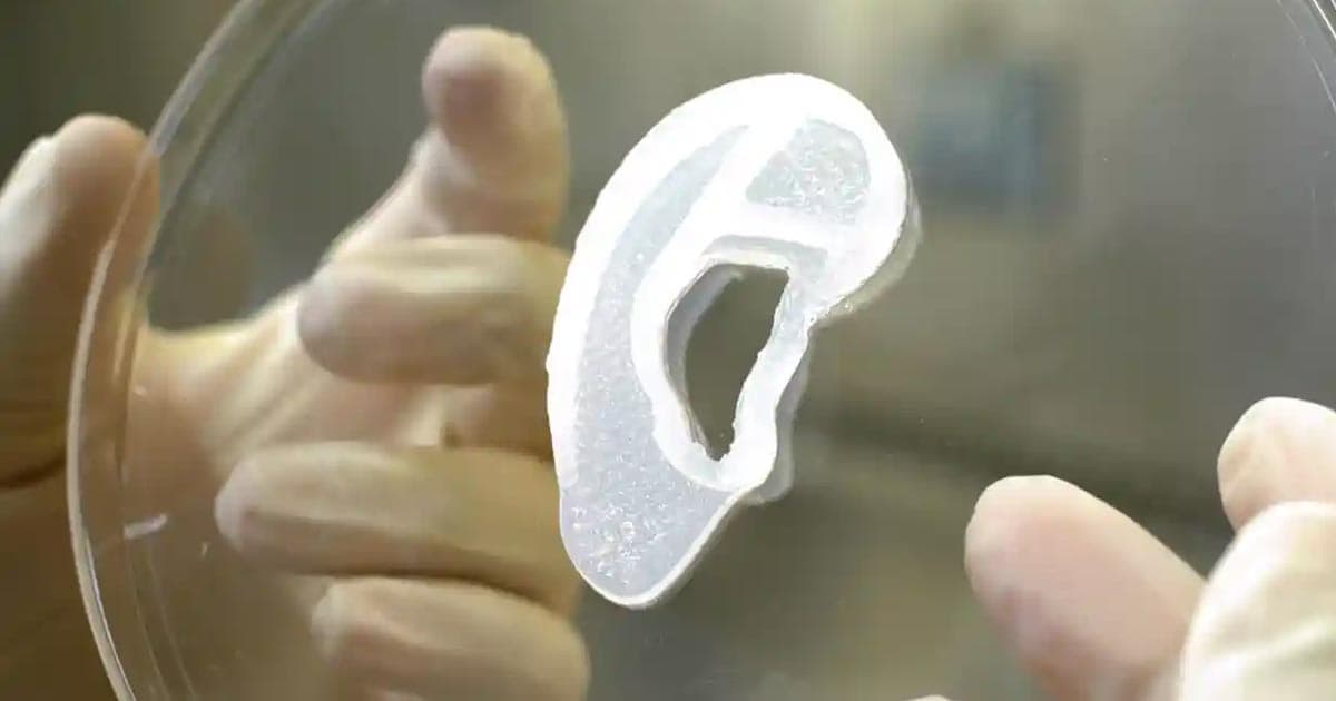 Doctors Transplant Ear That Was 3D Printed With Patient's Own Cells Image?url=https%3A%2F%2Fwp-assets.futurism.com%2F2022%2F06%2Fdoctors-transplant-ear-3d-printed-patients-own-cells