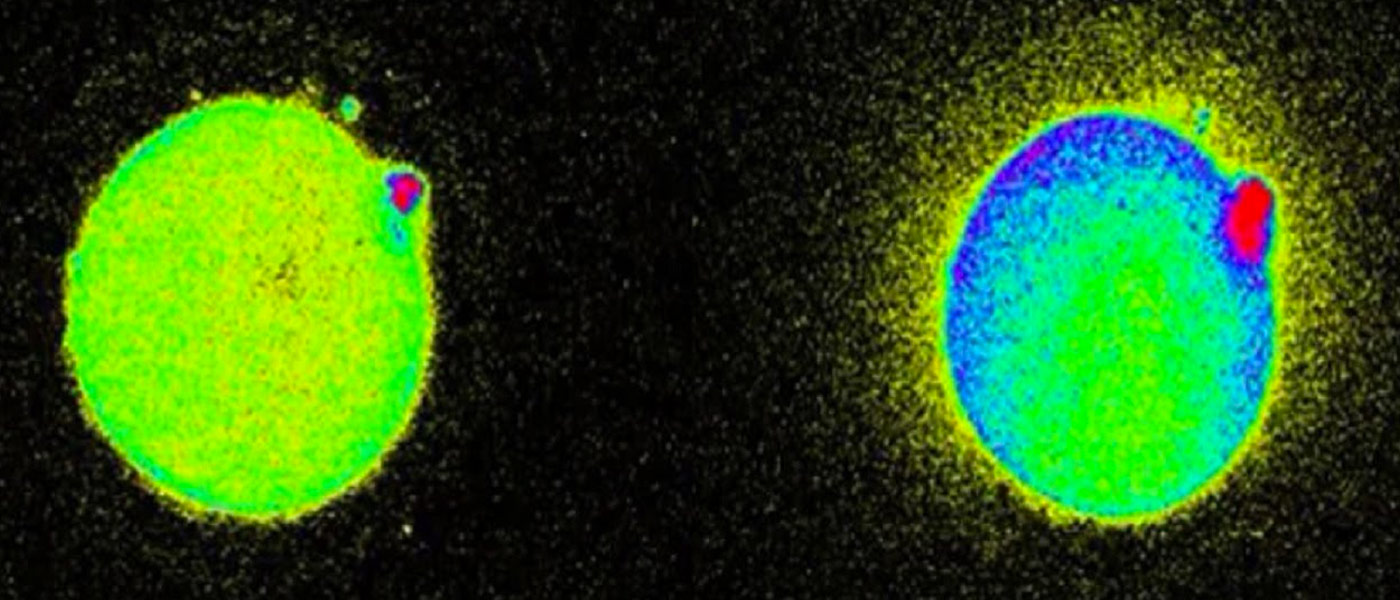 Real Conception Eggs Literally Spark With Light Upon Contact With Sperm, and We Caught ...
