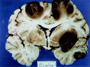 Credit:  A. J. Martinez