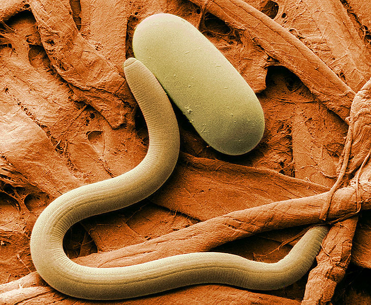 Soybean cyst nematode and its egg. Magnified 1,000 times via Agricultural Research Service