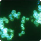 Antibiotic-Resistant Gonorrhea via CDC