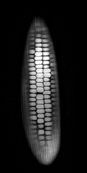 MRI 1