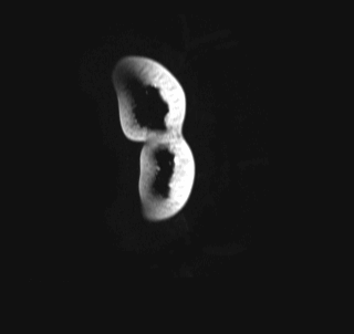 MRI 10
