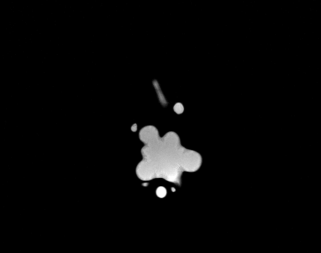 MRI 11