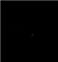 MRI 12