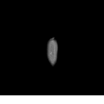 MRI 13