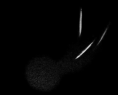 MRI 14
