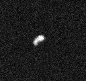 MRI 15