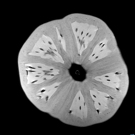 MRI 18