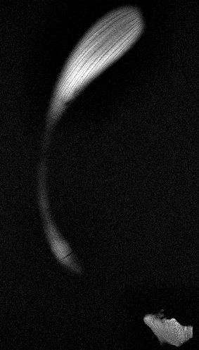 MRI 2
