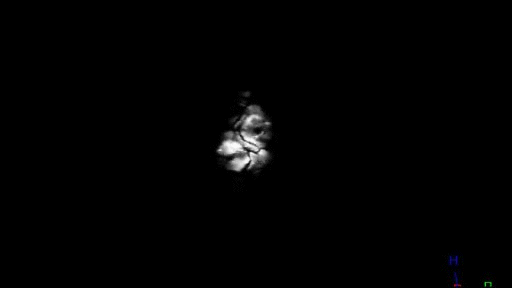 MRI 3