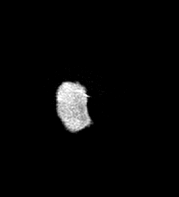 MRI 4