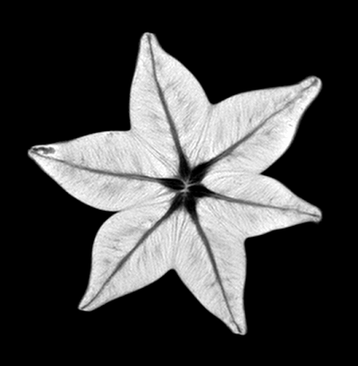 MRI 5