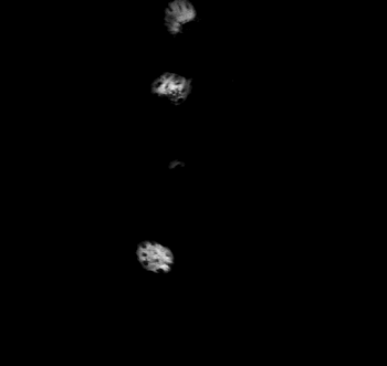 MRI 6
