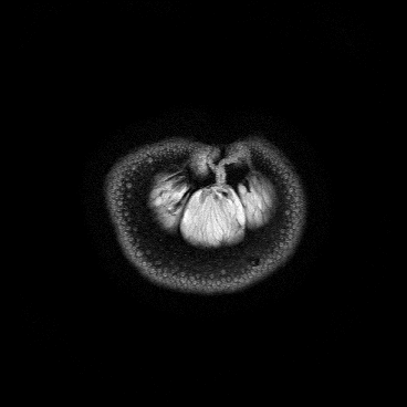 MRI 9