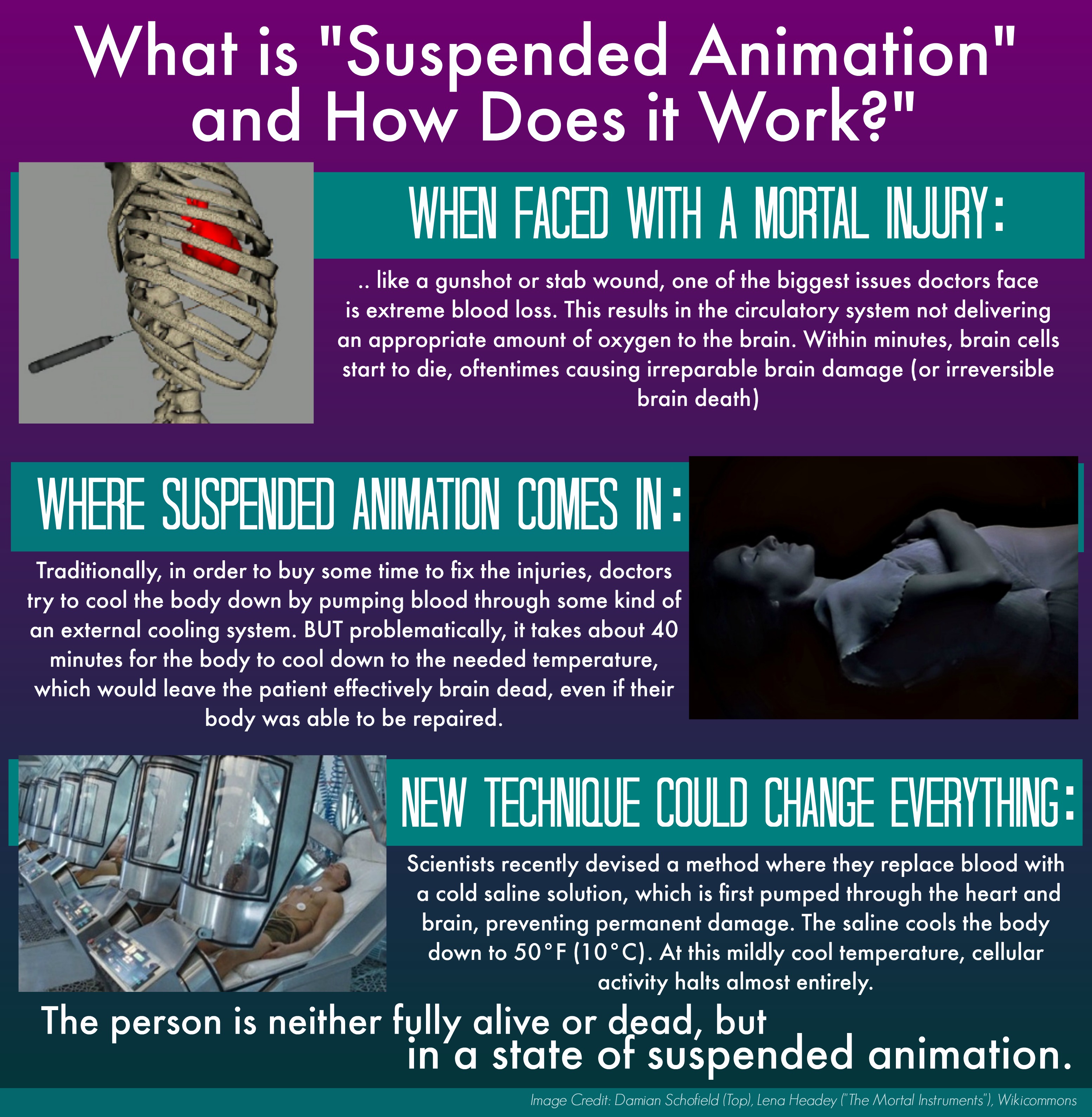 Suspended Animation Infographic