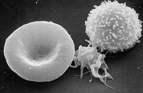 Microscope image of a red blood cell, platelet, and white blood cell Image via (NCI-Frederick)