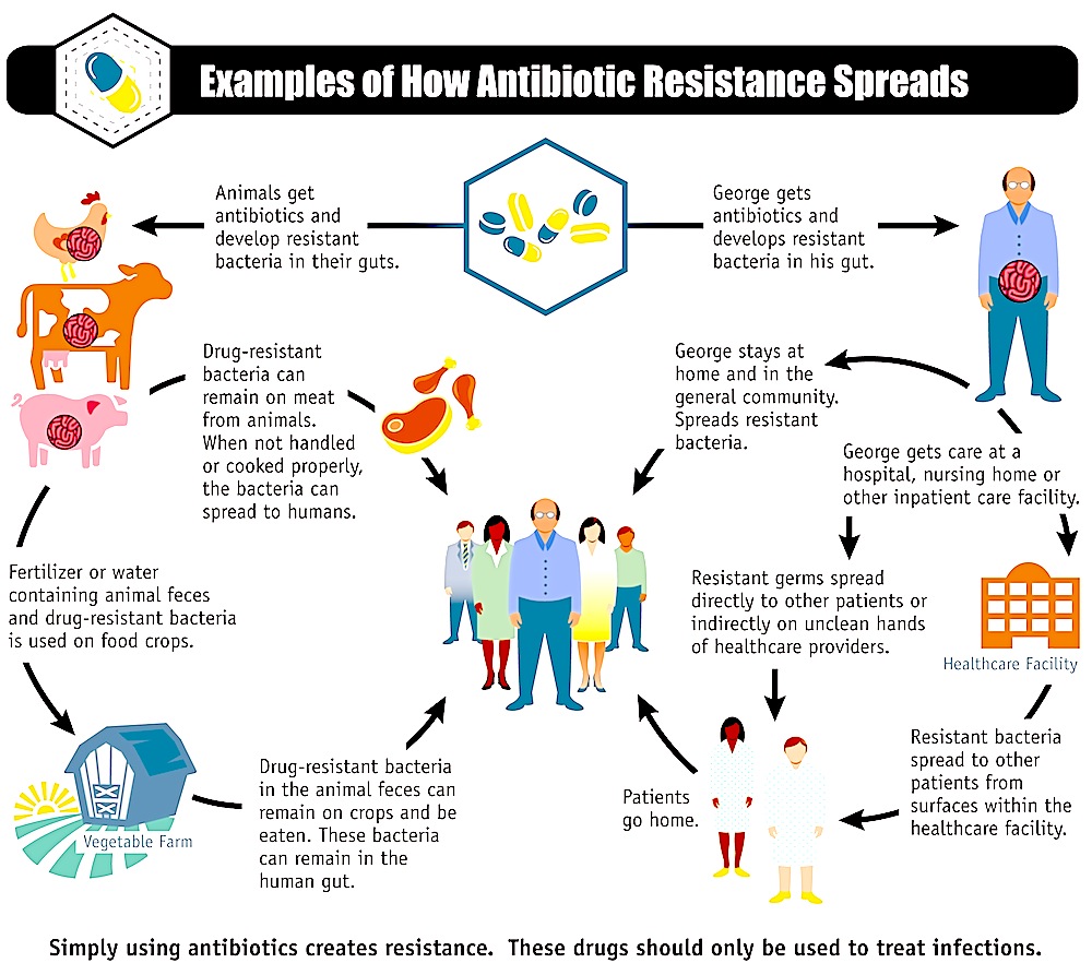 Image via Center for Disease Control