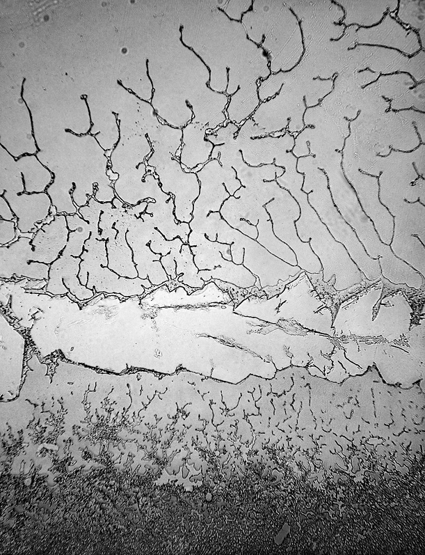 "Basal Tears." Credit: Rose-Lynn Fisher