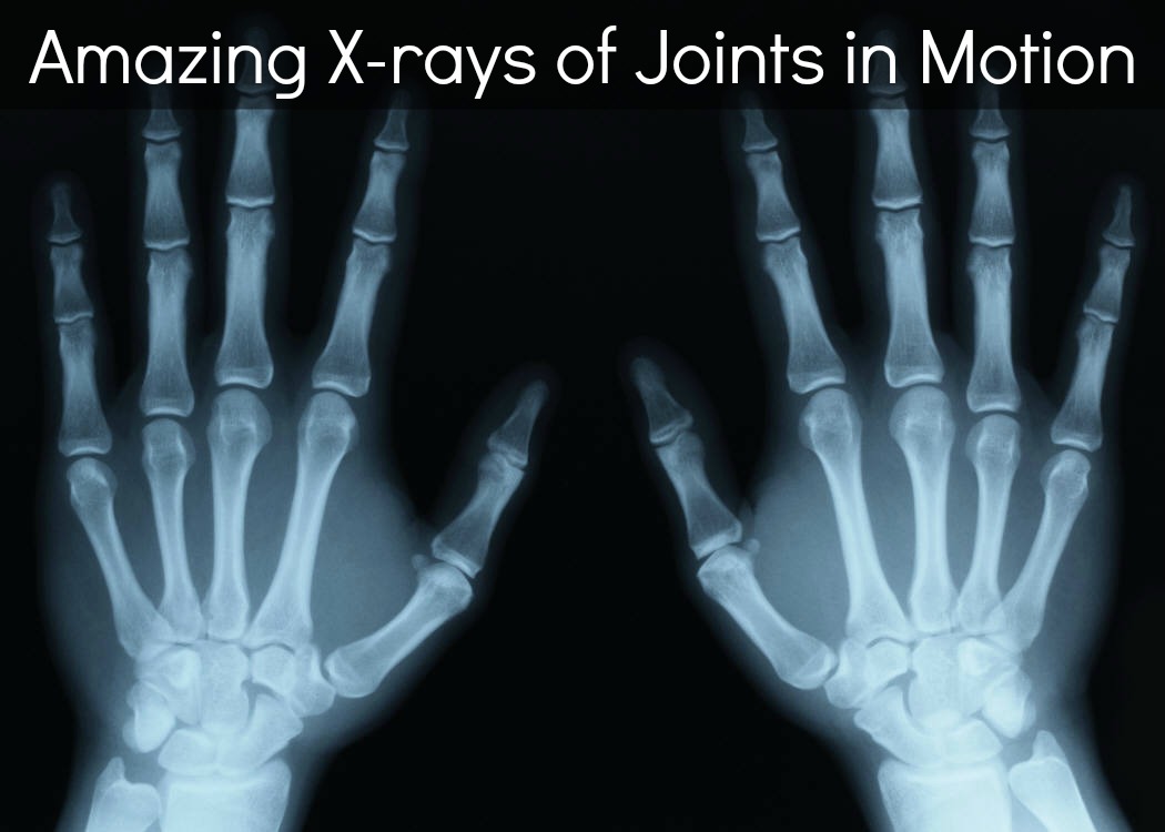 x-ray