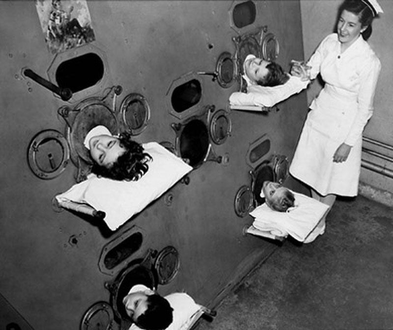 polio