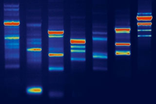 gel electrophoresis