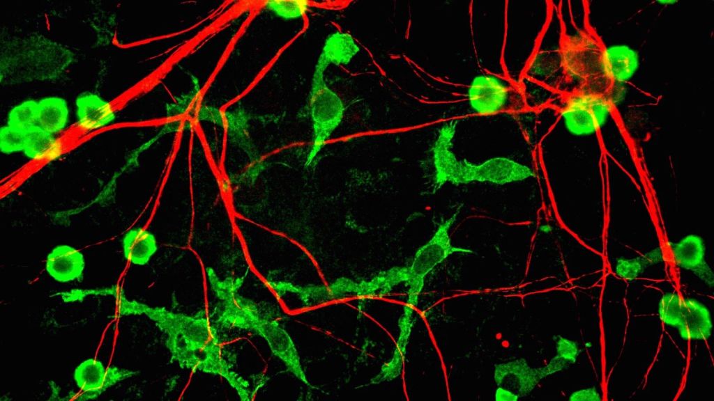 Microglia (green) among neurons (red)