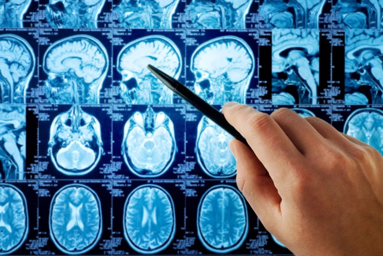 Human radiologists missed 7% of cancers in a study, a deep learning algorithm missed 0%