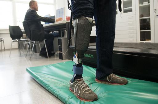 World’s first ‘feeling’ leg prosthesis offers hope to amputees