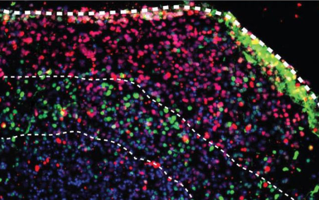 Scientists are Growing Tiny Human Brain Balls in Petri Dishes