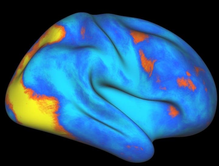 Brain Network that Controls, Redirects Attention Identified