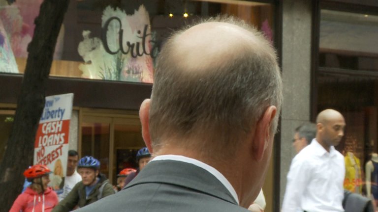 ‘We’ve Found a Cure for Baldness,’ Says Japan’s Shiseido