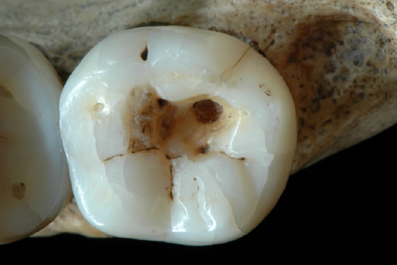 oldest-dentistry_01