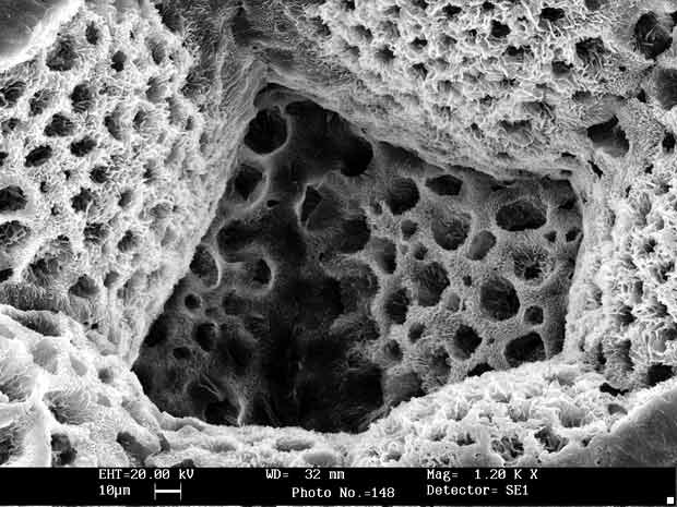 1-scaffold-for-bone