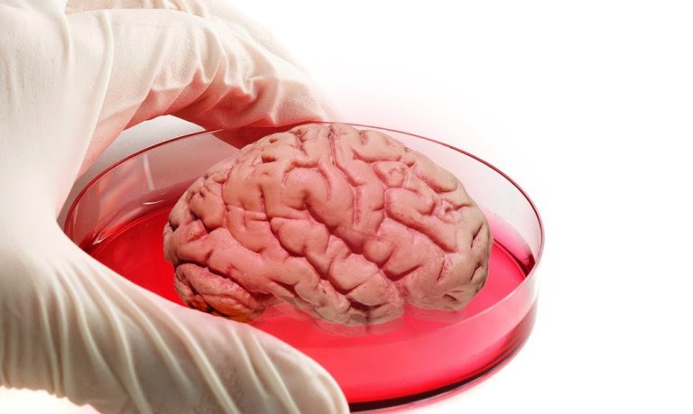 Lab-Grown Brain Could Revolutionize Alzheimer’s Research…If It Works