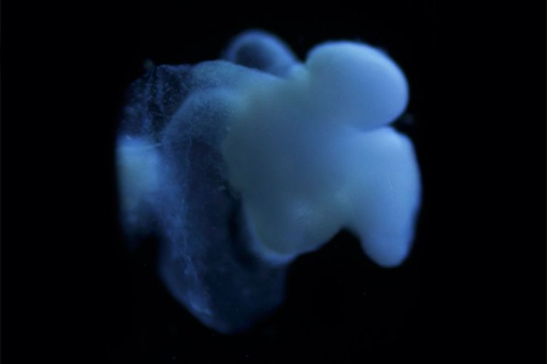 Ohio State’s Lab-Grown “Mini Human Brain” is Dubious and Sketchy