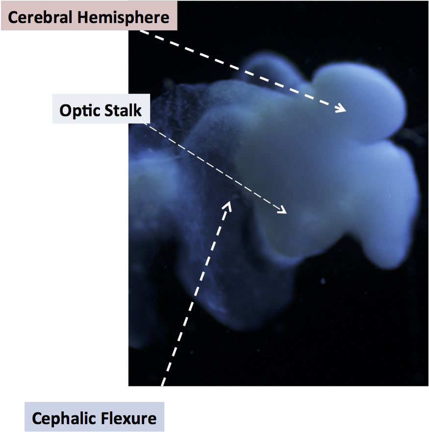 labeled brain organoid