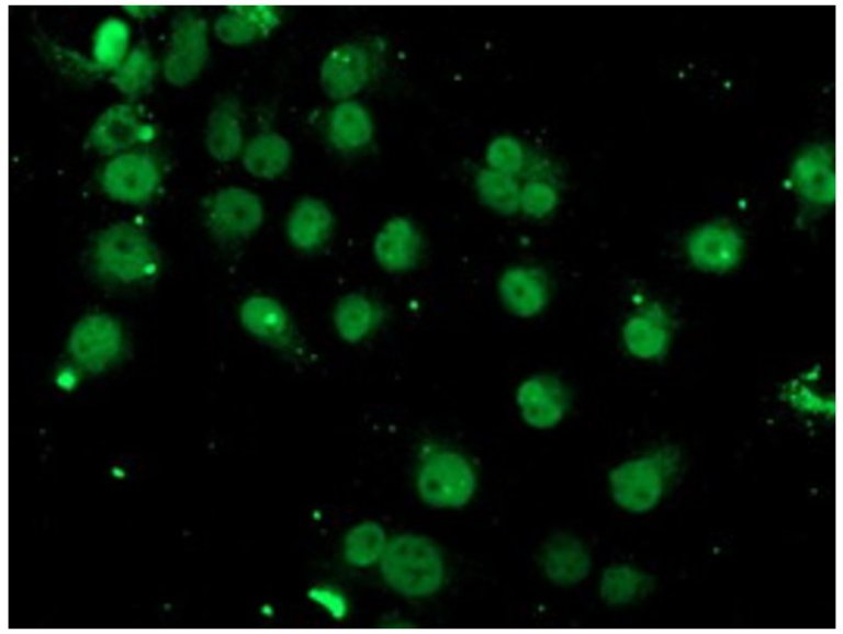 This mitochondrial protein may help develop therapeutics for conditions like cancer