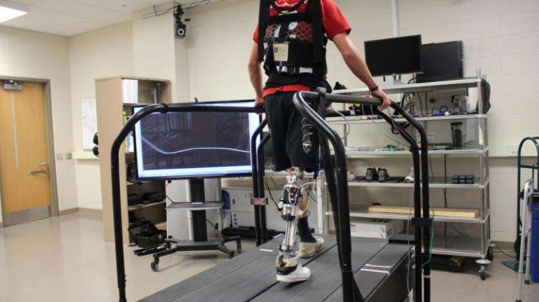 Software customizes powered prosthetics to reduce trips to the doctor