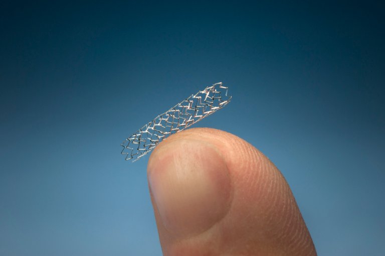 This New Heart Stent Works Like Dissolving Stitches